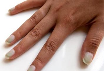 Come sbiancare le unghie: modi semplici per la casa