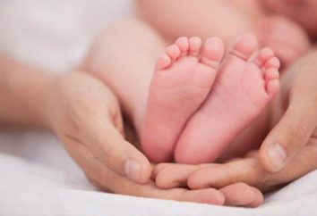 Como determinar pés chatos da criança e em que idade é possível fazer?