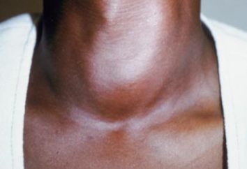 Les premiers signes de la thyroïde: ce qu'il faut pour