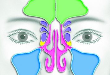 sinus nez. scanner des sinus paranasaux