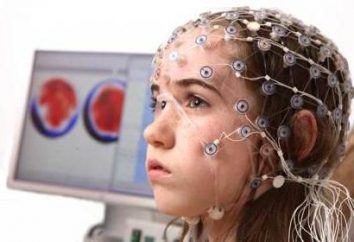 cerveau encéphalogramme: pourquoi cette procédure?