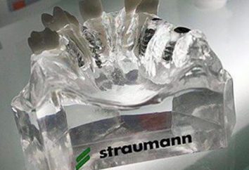 Gli impianti "Straumann": caratteristiche, tipologie, e recensioni