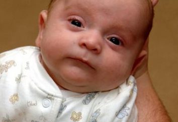 Was ist Anämie bei Neugeborenen