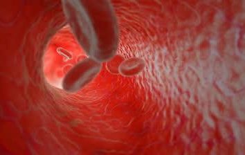 Krwawienie krwionośne: co to jest i jak go zatrzymać