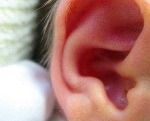 Che cosa succede se pedine orecchie, e perché succede?