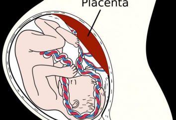 La rimozione manuale di placenta: metodi e le prestazioni delle apparecchiature