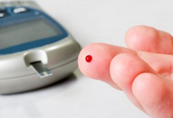 Reduziert Blutzucker: Ursachen und Symptome