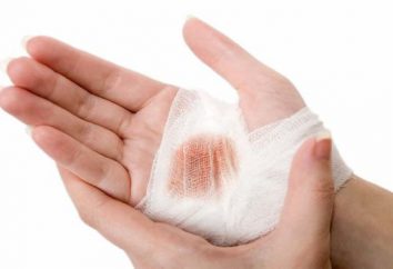 Eficaz pomada de cicatrização de feridas: efeito rápido. medicamentos