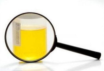 oxalate Apparue dans l'urine de l'enfant: causes, symptômes, traitement