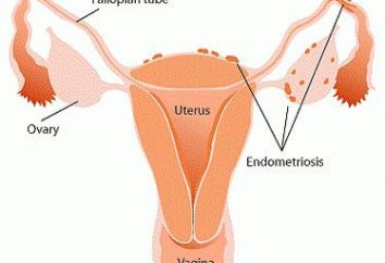 "Djufaston" Endometriosi – recensioni. Efficienza "duphaston" prezzo
