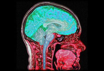 Qual è la diagnosi della risonanza magnetica? La possibilità di MRI diagnostica. La diagnosi di MRI del cervello. Recensioni di diagnosi MRI