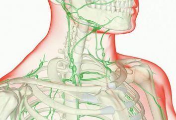 Crile Chirurgie: Indikationen, Beschreibung, mögliche Komplikationen. Lymphknoten im Hals