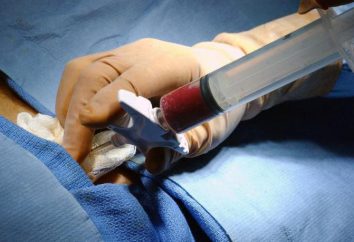 Tipi di biopsia e indicazioni di conduzione