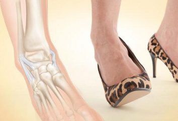 Estirando los ligamentos del tobillo: causas, síntomas y tratamientos