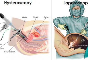 Laparoscopia e histeroscopia: leitura, comentários, é melhor