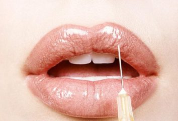 Comment augmenter les lèvres à la maison et sans frais supplémentaires?