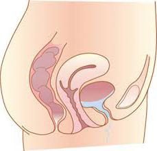 Cewka moczowa – co to jest? Różnice w strukturze cewki moczowej u mężczyzn i kobiet, a objawy choroby