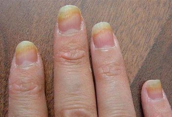 "Lotseril" de hongos en las uñas: opiniones, forma de liberación, estructura, manual de instrucciones. laca de uñas antifúngica Lotseril