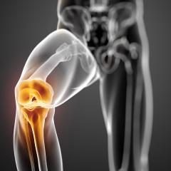 Conseguenze di lesioni del ginocchio. Protesi e riabilitazione