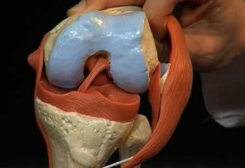 das Knie Ligamentoz: was es ist, die Ursachen und Behandlung