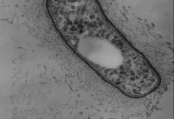 bactéries nodule – organismes symbiotiques qui fixent l'azote