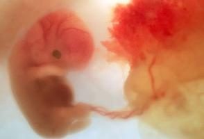 Placenta – es el principal órgano para la madre y el bebé!