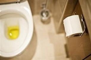 Perché l'urina è giallo?