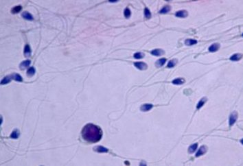 Teratozoospermia – ¿qué es? Las principales causas de la infertilidad masculina
