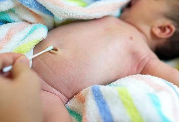 Podczas gojenia pępka noworodka, zwłaszcza przetwarzania i zalecenia