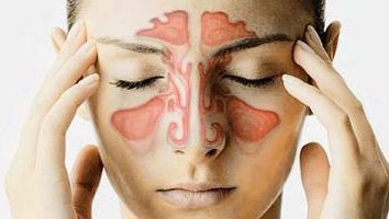 L'inflammation des sinus, ou Qu'est-ce que la sinusite