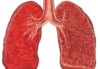 Tuberculose pulmonaire pulmonaire: formes, diagnostic, symptômes, traitement