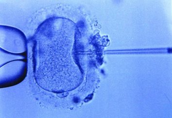 Quanto é que a fertilização in vitro? Fertilização in vitro: clínica