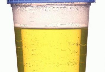 Trehstakannaya campione di urina. Che tipo di analisi e come consegnarlo?