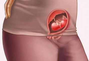 Assegnazione dei giallo-verde con la gravidanza precoce e inodore – è pericoloso o no?