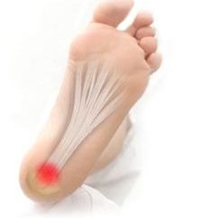 Detalhes sobre por que o pé do calcanhar dolorido