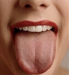 Weiße Zunge – ein Zeichen dessen, was? Wir untersuchten zusammen