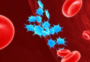 Les faibles niveaux de plaquettes dans le sang: les causes et les moyens d'améliorer