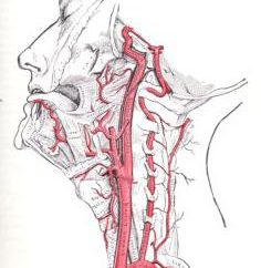 Hipoplasia da artéria vertebral esquerda. Causas. Sintomas. tratamento