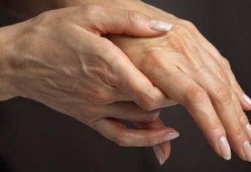 Medicina per le articolazioni – curare l'artrite