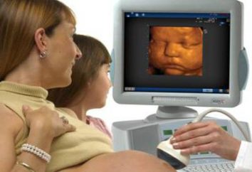 ecografia 3D durante la gravidanza