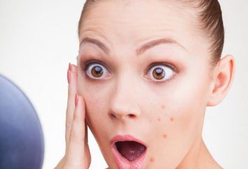 ¿Qué pasa si en la cara de ebullición? Cómo tratar correctamente? Medicamentos y recomendaciones de los médicos