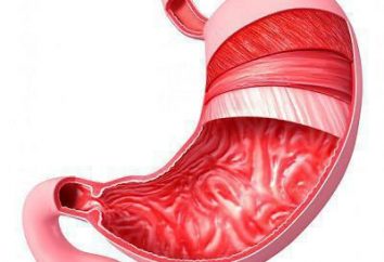 gastritis superficial crónica: síntomas, el tratamiento, la dieta