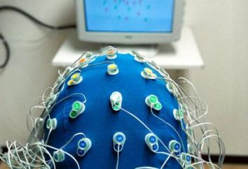 Elektroenzephalographie – was ist das? Wie ist die Elektroenzephalographie?