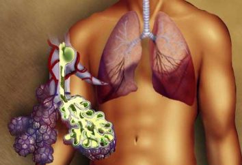 Prawostronne zapalenie płuc: przyczyny, objawy i leczenie