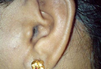 Dlaczego swędzenie wewnątrz ucha