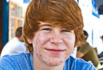 El acné en los adolescentes: tratamiento, causas, medicamentos. El acné en los adolescentes