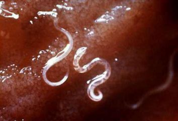 Brauchen wir die Würmer bei Erwachsenen Prävention. Medikamente für Würmer: Pillen und Tinkturen