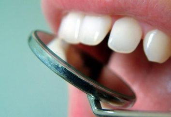 Pourquoi les maux de dents après le retrait du nerf: causes possibles et le traitement