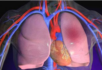 Thromboembolie de petites branches de l'artère pulmonaire: causes, symptômes et diagnostic