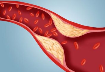 La norme de cholestérol dans le sang des hommes. Les indicateurs de cholestérol dans le sang